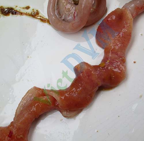 Niêm mạc ruột non bị cầu trùng tấn công Niêm mạc ruột non bị cầu trùng tấn công