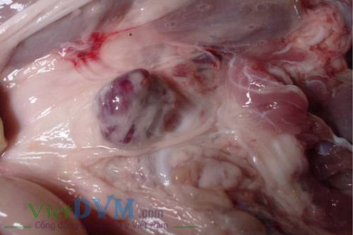 Hạch bạch huyết sưng to, xuất huyết Hạch bạch huyết sưng to, xuất huyết