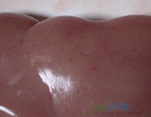 Xuất huyết ở vỏ ngoài của thận Xuất huyết ở vỏ ngoài của thận