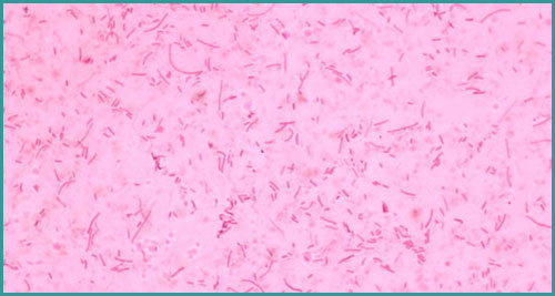 Vi khuẩn Haemophilus parasuis gây bệnh glasser Vi khuẩn Haemophilus parasuis gây bệnh glasser