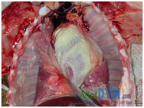 Màng phổi và xoang ngực viêm - có dịch và fibrin bám dính trong bệnh glasser Màng phổi và xoang ngực viêm - có dịch và fibrin bám dính trong bệnh glasser