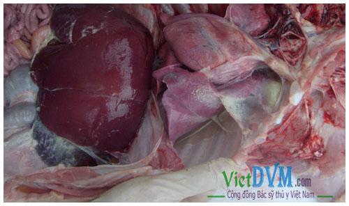 Viêm đa xoang (bụng và xoang ngực bị viêm) Viêm đa xoang (bụng và xoang ngực bị viêm)