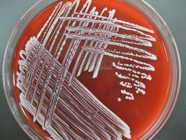 Staphylococcus hyicus trong phòng thí nghiệm (ảnh internet). Staphylococcus hyicus trong phòng thí nghiệm (ảnh internet).