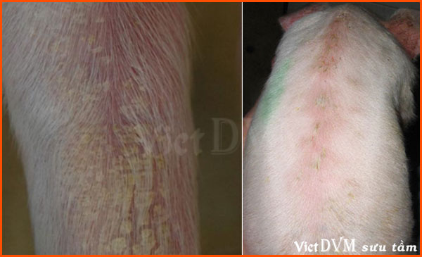 Bệnh viêm da do tụ cầu - Xuất hiện các mụn nước và có thể có mủ bên trong. Các nốt mụn này có thể bị viêm đỏ ửng và khi loét ra thì có mủ trắng. Kích thước không cố định. Bệnh viêm da do tụ cầu - Xuất hiện các mụn nước và có thể có mủ bên trong. Các nốt mụn này có thể bị viêm đỏ ửng và khi loét ra thì có mủ trắng. Kích thước không cố định.