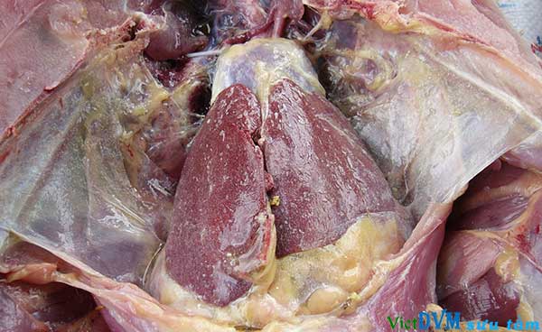 Cặn urat trên gan Cặn urat trên gan