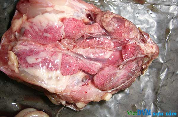 Thận lắng cặn urat Thận lắng cặn urat