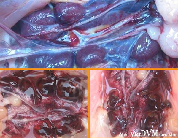 Xuất huyết ở thận trong bệnh ký sinh trùng đường máu Xuất huyết ở thận trong bệnh ký sinh trùng đường máu