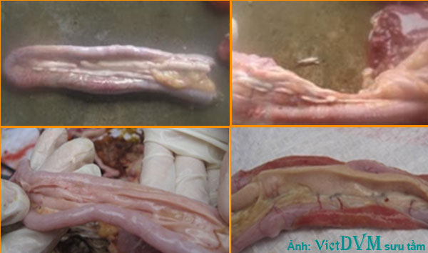 Xuất huyết ở ruột trong bệnh ký sinh trùng đường máu Xuất huyết ở ruột trong bệnh ký sinh trùng đường máu