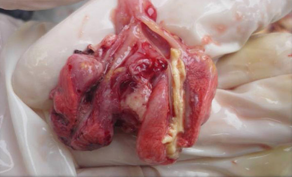 Bệnh ORT - Cục mủ viêm trong phổi benh ort cuc mu viem trong phoi 1