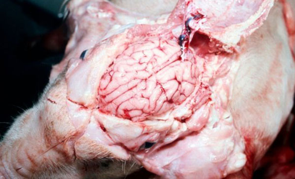 Hình 5: mở hộp sọ quan sát thấy não “ướt”. Hình 5: mở hộp sọ quan sát thấy não “ướt”.