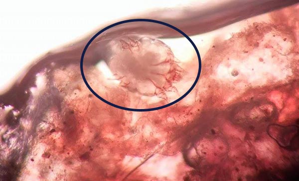 Ghẻ sarcoptes qua kính hiển vi Ghẻ sarcoptes qua kính hiển vi