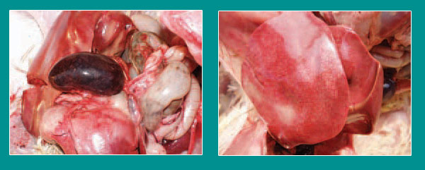 Ecoli nhiễm trùng huyết thứ phát do viêm ruột Ecoli nhiễm trùng huyết thứ phát do viêm ruột