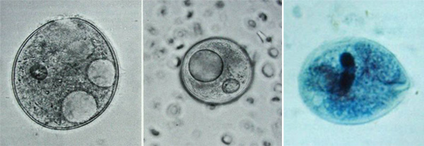 Balantidium Coli Balantidium Coli