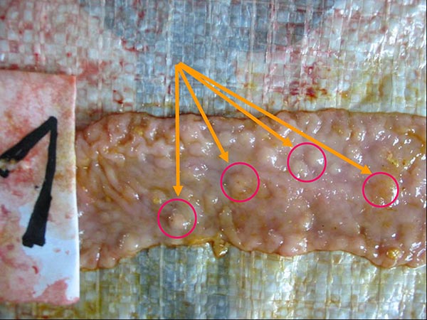 Ruột heo mắc bệnh B.Coli Ruột heo mắc bệnh B.Coli