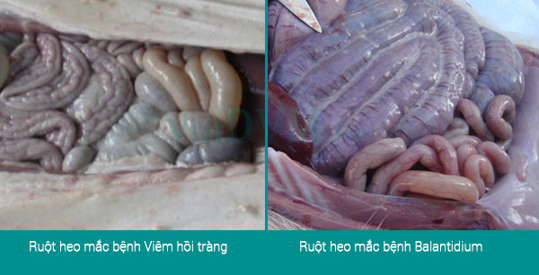 U hạt trắng bám trên thành ruột của heo nhiễm Balantidium coli và Thành ruột của heo bị viêm hồi tràng dày lên U hạt trắng bám trên thành ruột của heo nhiễm Balantidium coli và Thành ruột của heo bị viêm hồi tràng dày lên