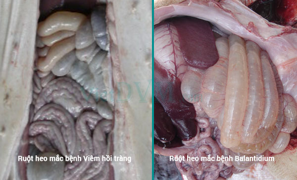 Phân biệt 2 bệnh qua biểu hiện bên ngoài của ruột Phân biệt 2 bệnh qua biểu hiện bên ngoài của ruột