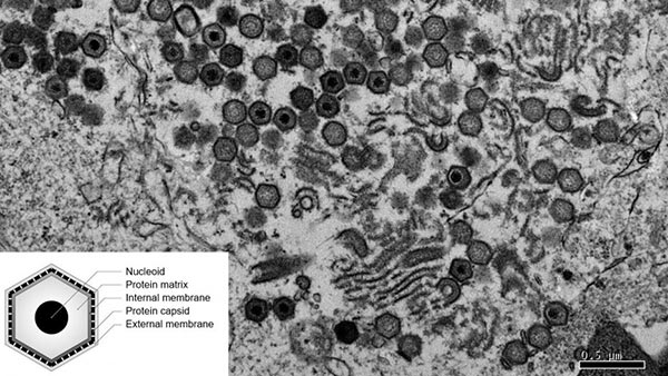 Hình ảnh qua kính hiển vi điện tử của tế bào heo bị nhiễm virus ASF Hình ảnh qua kính hiển vi điện tử của tế bào heo bị nhiễm virus ASF